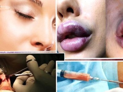 سلامت مردم بازیچه قوانین بر زمین مانده حوزه زیبایی!