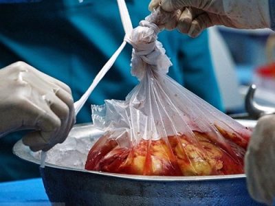 چهارمین اهدای عضو طی یک‌ماه در کرمانشاه ثبت شد