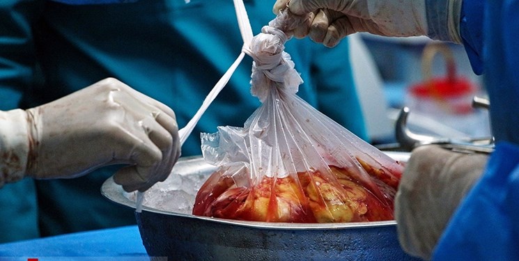 چهارمین اهدای عضو طی یک‌ماه گذشته در کرمانشاه ثبت شد